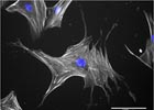 Nanokicking stem cells