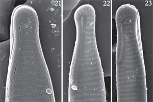 Image of a freshwater diatom creature