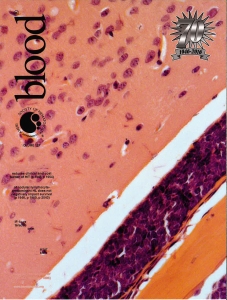 Blood, Volume 127, Number 16, April 21st 2016
http://www.bloodjournal.org/content/127/16/1998