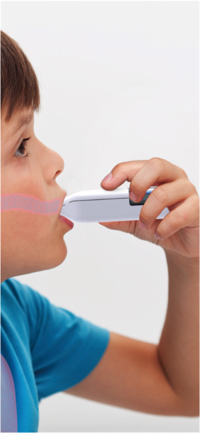 A young boy holds the Nebu-Flow nebulizer to his mouth. An overlay graphic shows medication being dispensed from the nebulizer into the boy's mouth.