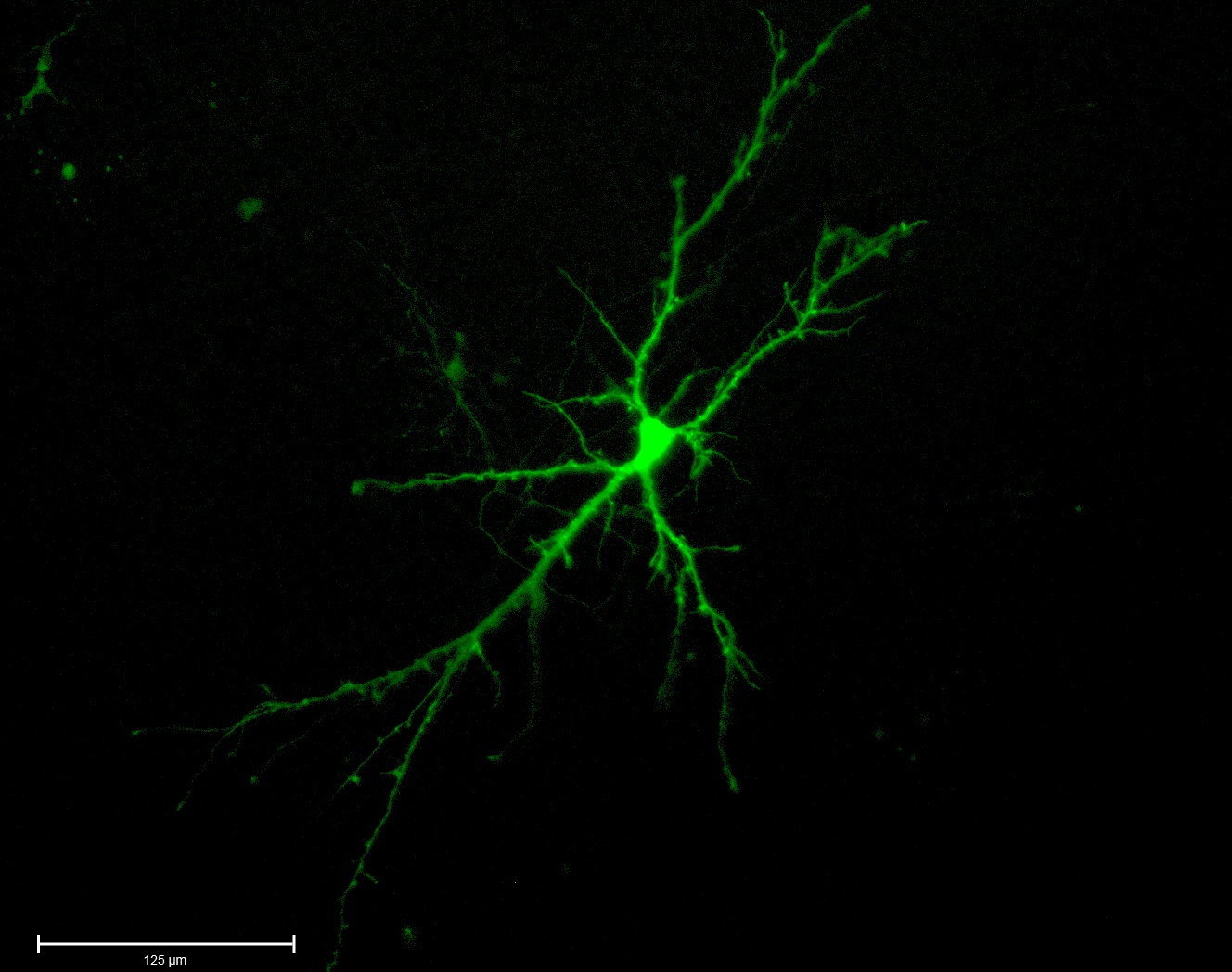 A neuron, or brain cell, glows green on a black background.