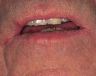 exam_lips