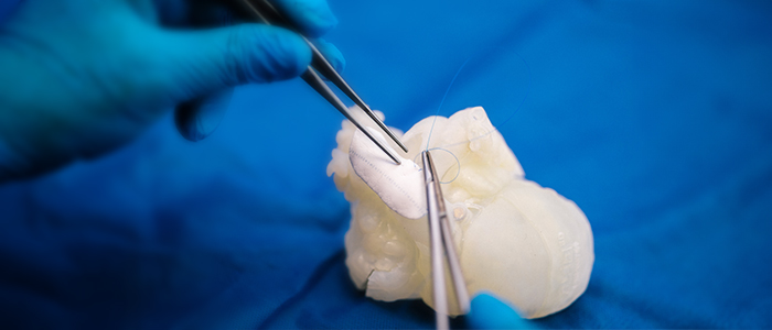 Medical Suture