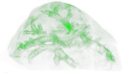 Influenza virus-infected mouse lung. Virus show as green colour. 