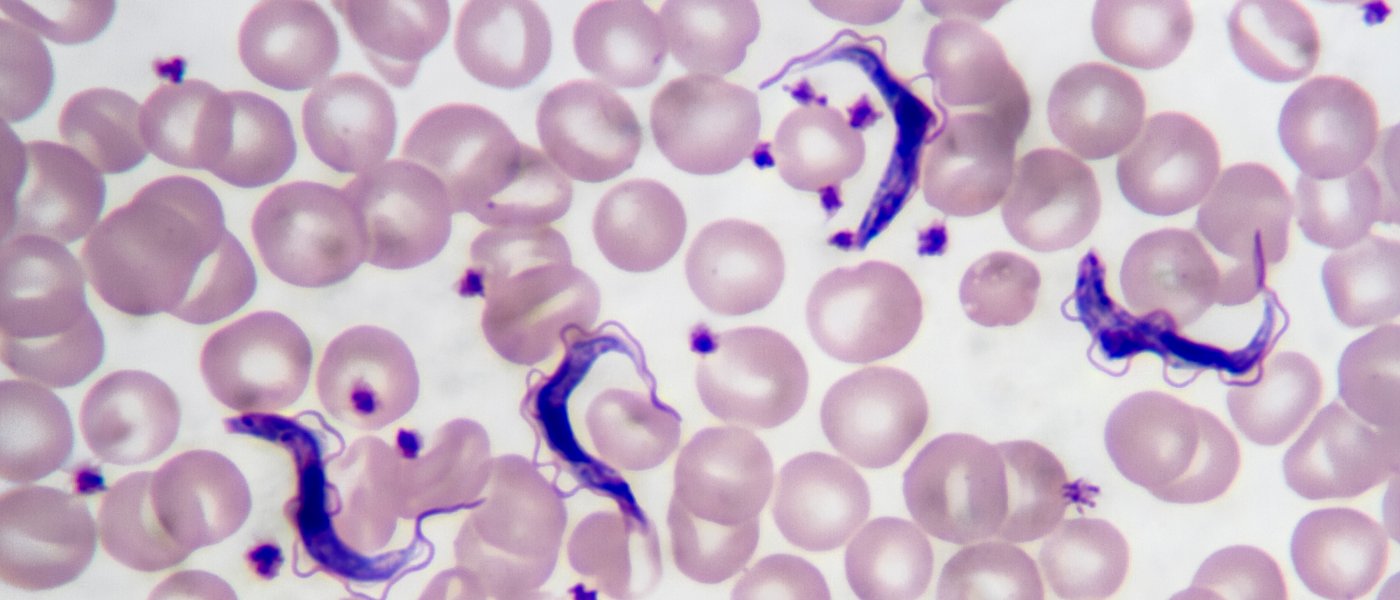 Trypanosoma gambiense blood smear viewed under a microscope at 1250 power