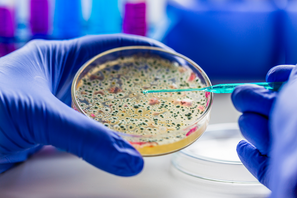 Gloved hands holding bacteria culture in a petri dish