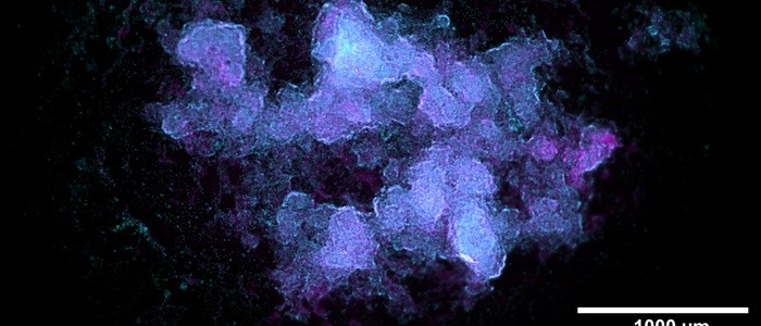 Microscopy images of bacterial/fungal biofilm aggregates in simulated microgravity