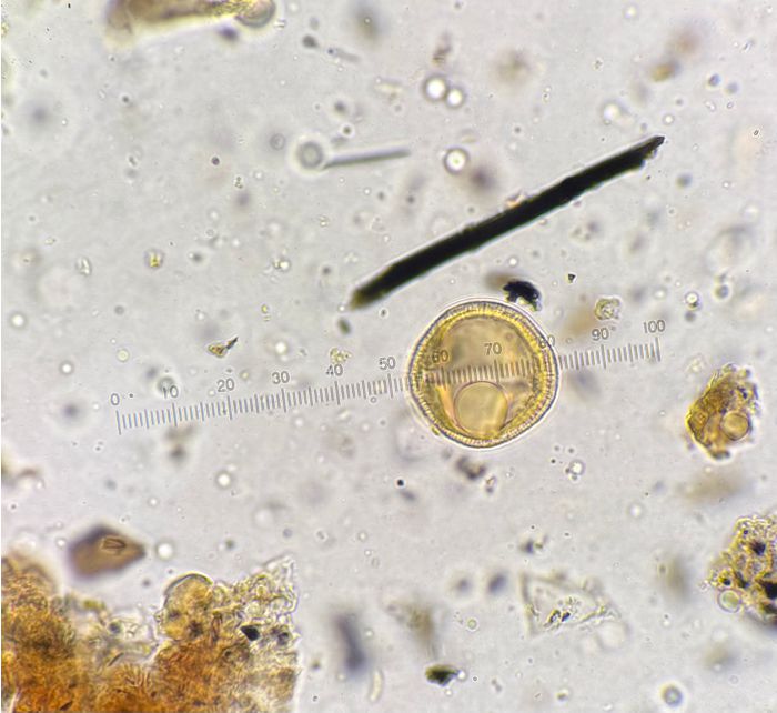 view of pollen under a microscope