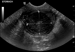 An ultrasound scan shows the potato stuck in Angus's stomach.