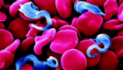 Colourised SEM of T. brucei and erythrocytes