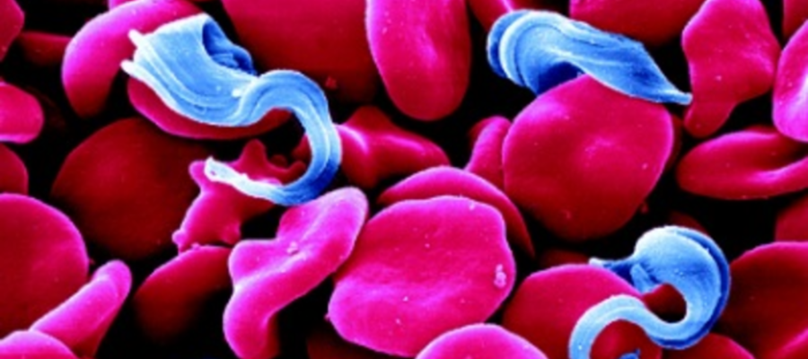 Colorized SEM of T. brucei and erythrocytes