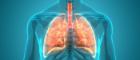 Illustration of lung inflammation
