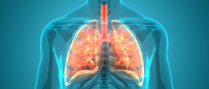 Illustration of lung inflammation