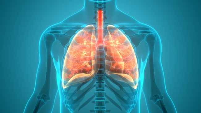 Illustration of lung inflammation