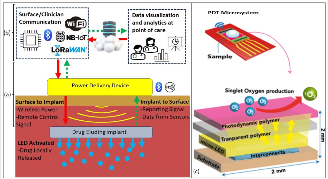 Implantable tech