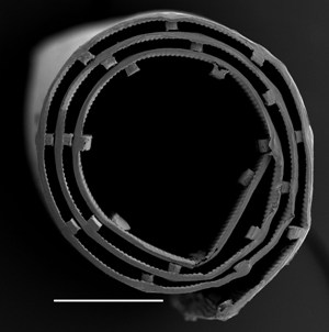 Polycaprolactone tube with internal guidance grooves. The scale is illustrated by the white bar on the bottom left which is 0.5mm long.