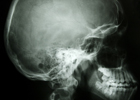 Skull x-Ray 140