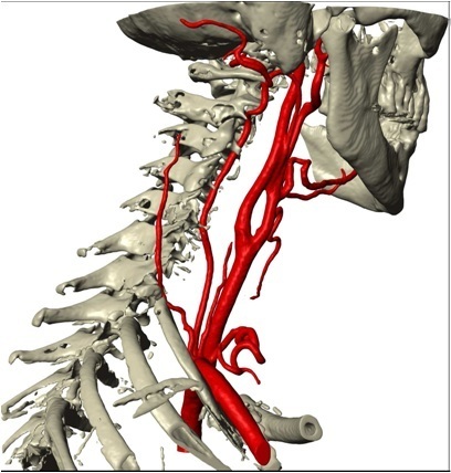 arteries image