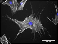 Nanokicking stem cells 2