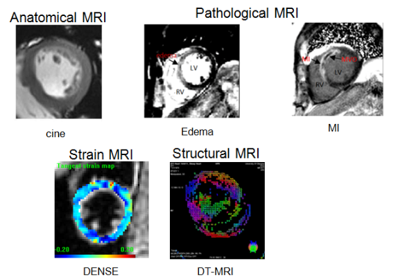 in vivo cmr images