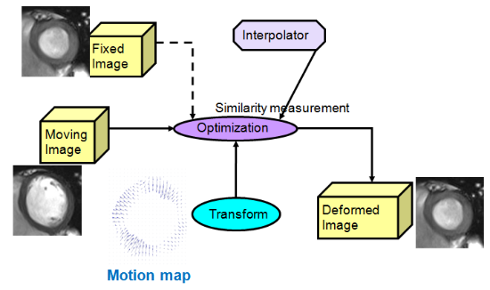 deformable image registration