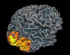 fMRI - visual activity