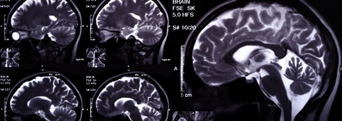 X-ray image of the brain computed tomography