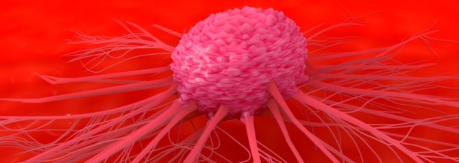 An illustration depicting a cancer cell attached to tissue within the body
