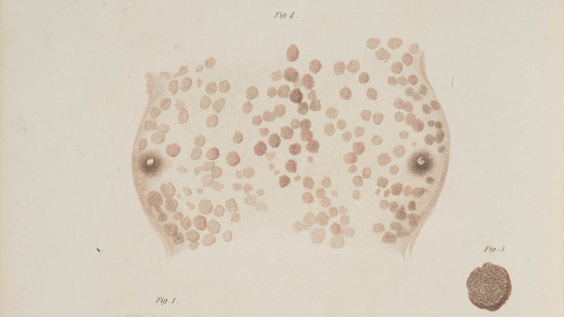 essay on the venereal diseases which have been confounded with syphilis
http://eleanor.lib.gla.ac.uk/record=b3077653