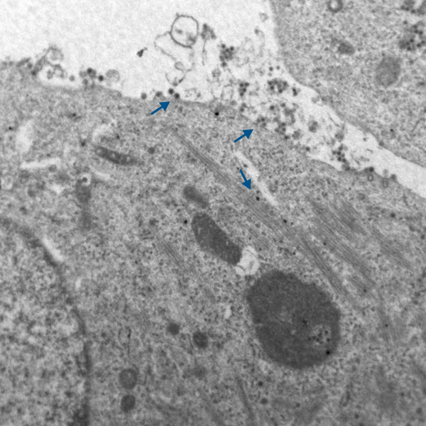 Bluetongue virus BTV electronmicrograph