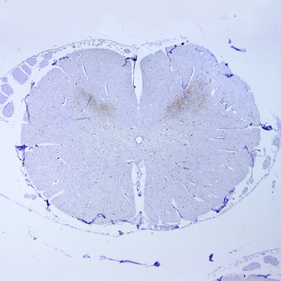 Section through an SBV infected spinal cord