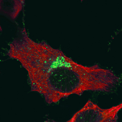 Fluorescently labelled Bunyamwera viral proteins viewed by confocal microscopy