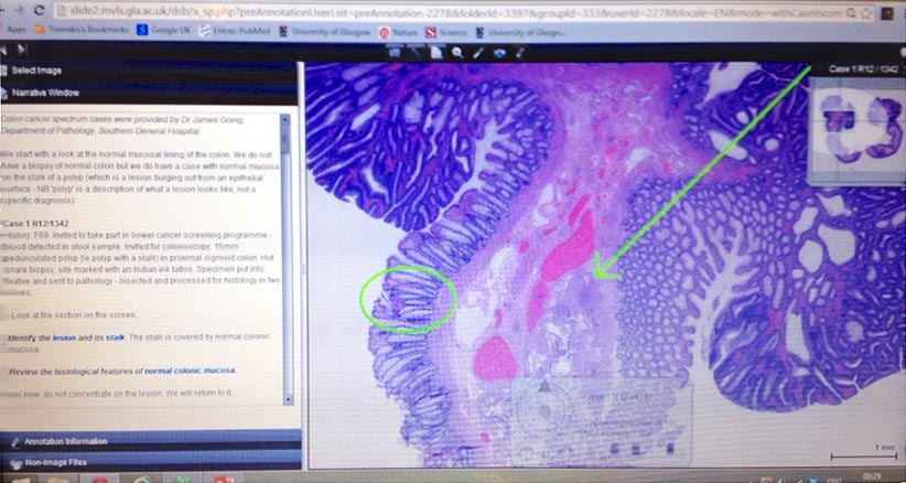 Example case: case history on the left plan and the scanned slide on the right which you can annotate in any way you want