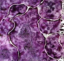 Microscope magnified view of osteoclast purple stained cells. Blotches in various shades of purple and outlined with white connect together to fill the image