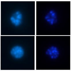 Microscope image of plasmodium