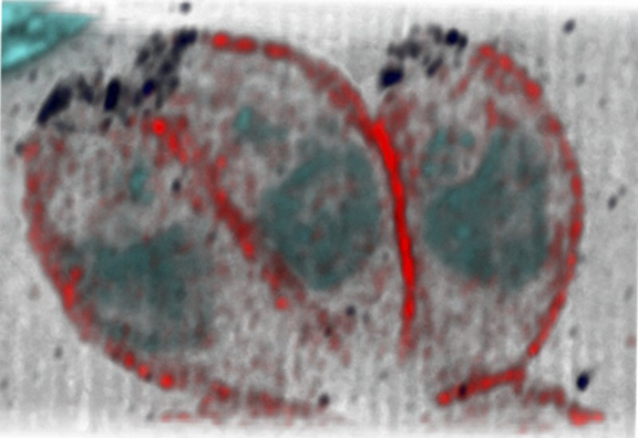 Toxoplasmosis-causing parasites