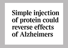 Alzheimers headlines