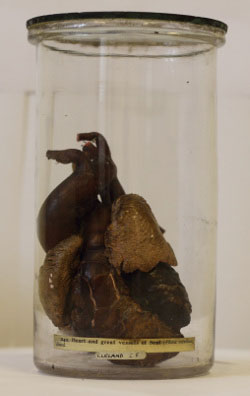 Dried heart of a harbour seal (Phoca vitulina), stored in a museum jar from Cleland’s collection (Cat. no. 120733), held by The Hunterian (Anatomy Museum)