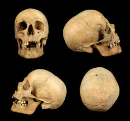 Caption: Skull from human skeleton, Tiree, Scotland. 
Credit: © The Hunterian, University of Glasgow 2016
