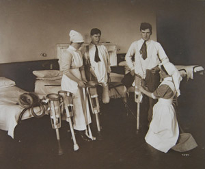 Artificial limb being adjusted by a limb fitter.