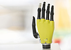 A prosthetic hand