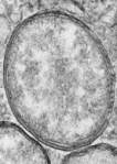 Image of a mosquito cell containing Wolbachia