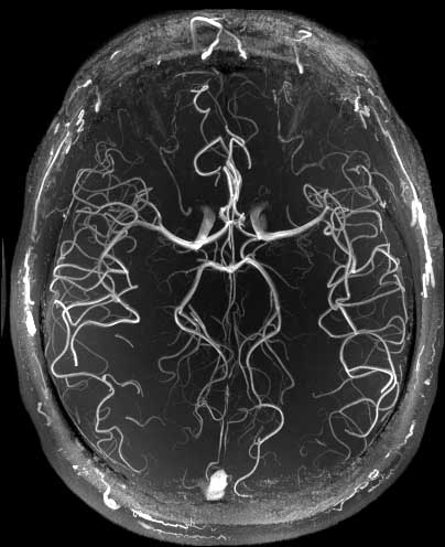 7T brain scan