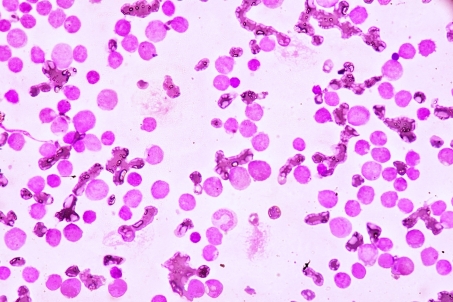 CML cells 450