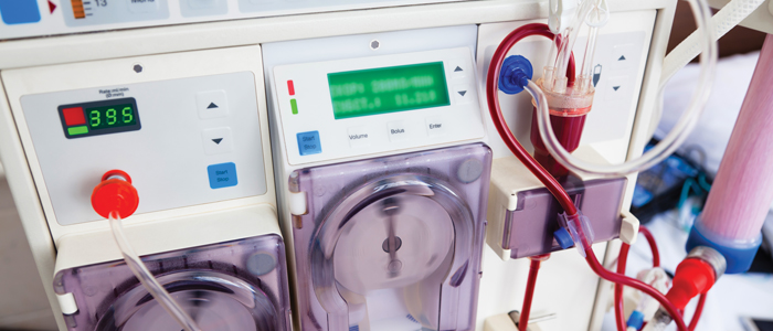 A modern-day kidney dialysis machine