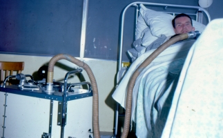 Respiratory paralysis in polio treated with cuirass -ve pressure ventilator