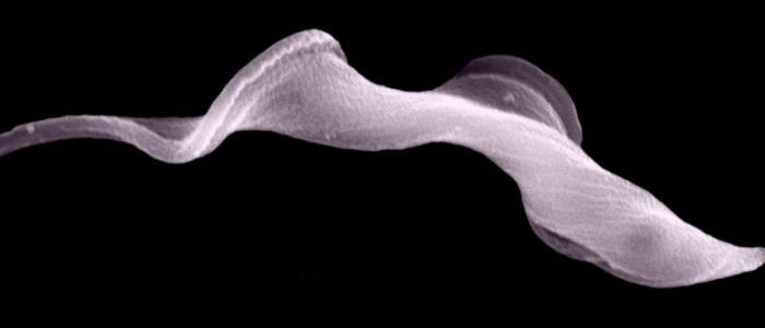 Image of a parasitic worm