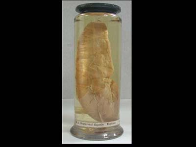 anatomical specimen of elephant suprarenal capsule (kidney) in spirit jar