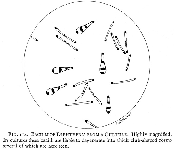 Bacilli of Diptheria from a Culture. Courtesy of the Wellcome Collection under the terms of the Creative Commons Attribution 4.0 International license (CC BY 4.0) 