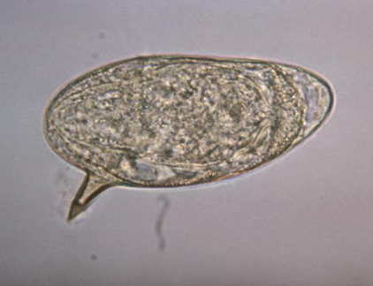 Schistosomiasis parasite egg